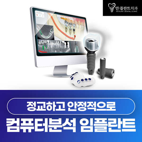 컴퓨터 분석 임플란트